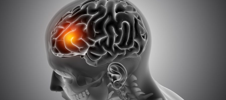 3D render of a male medical figure with front of the brain highlighted